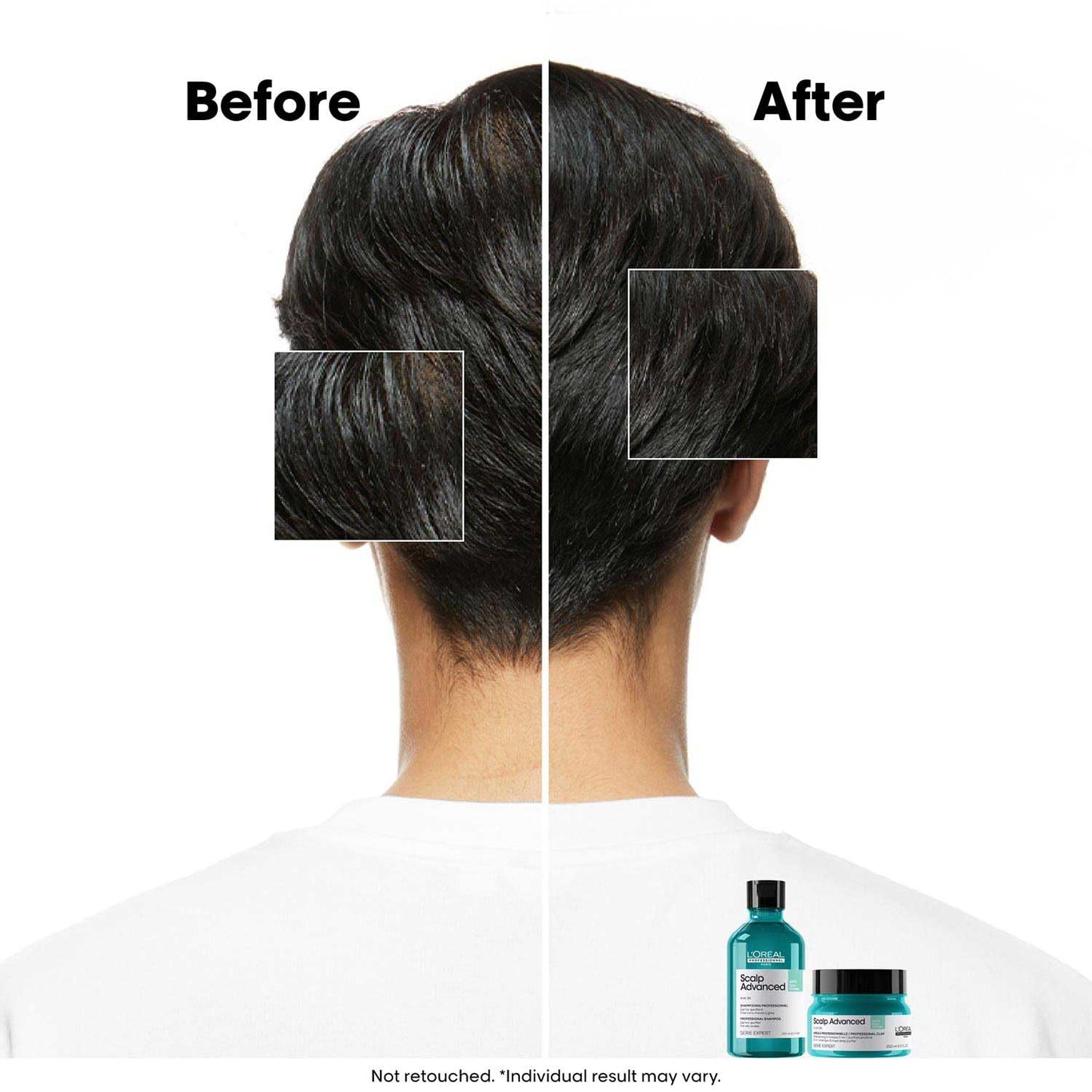 Before and after comparison of hair care product use on a person's head, with product bottles displayed below.
