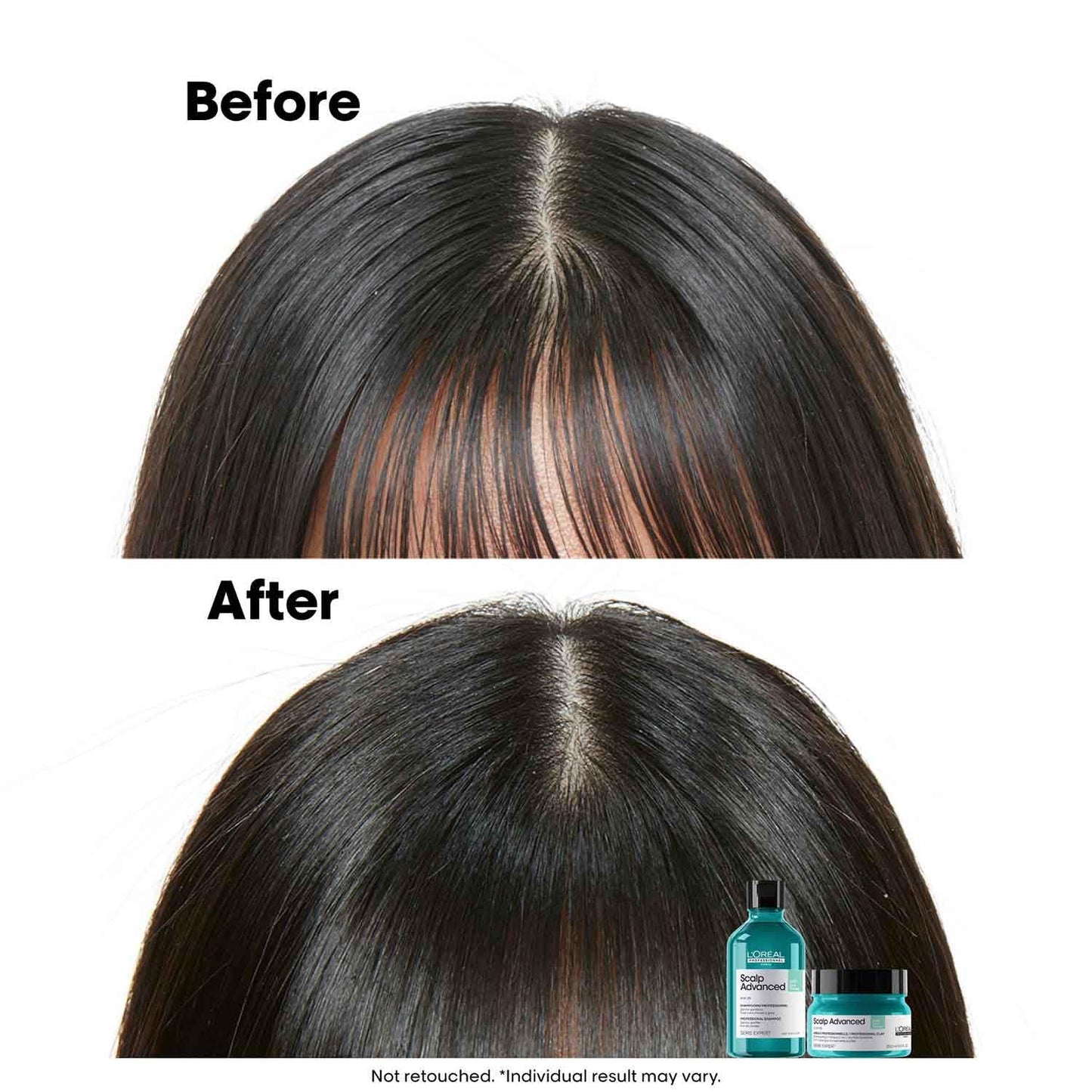 Before and after comparison of hair with a bottle and jar on a white background