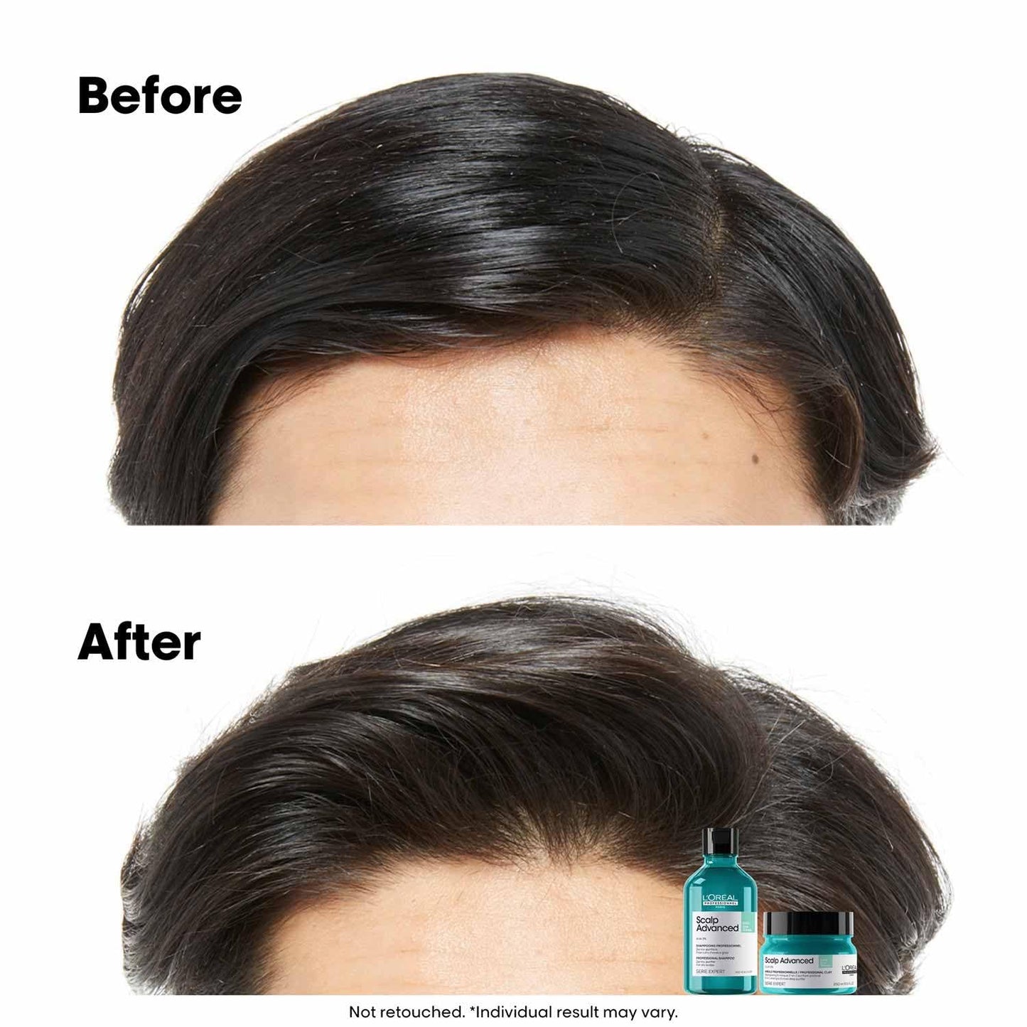 Before and after comparison of hair care product use on a person's head.
