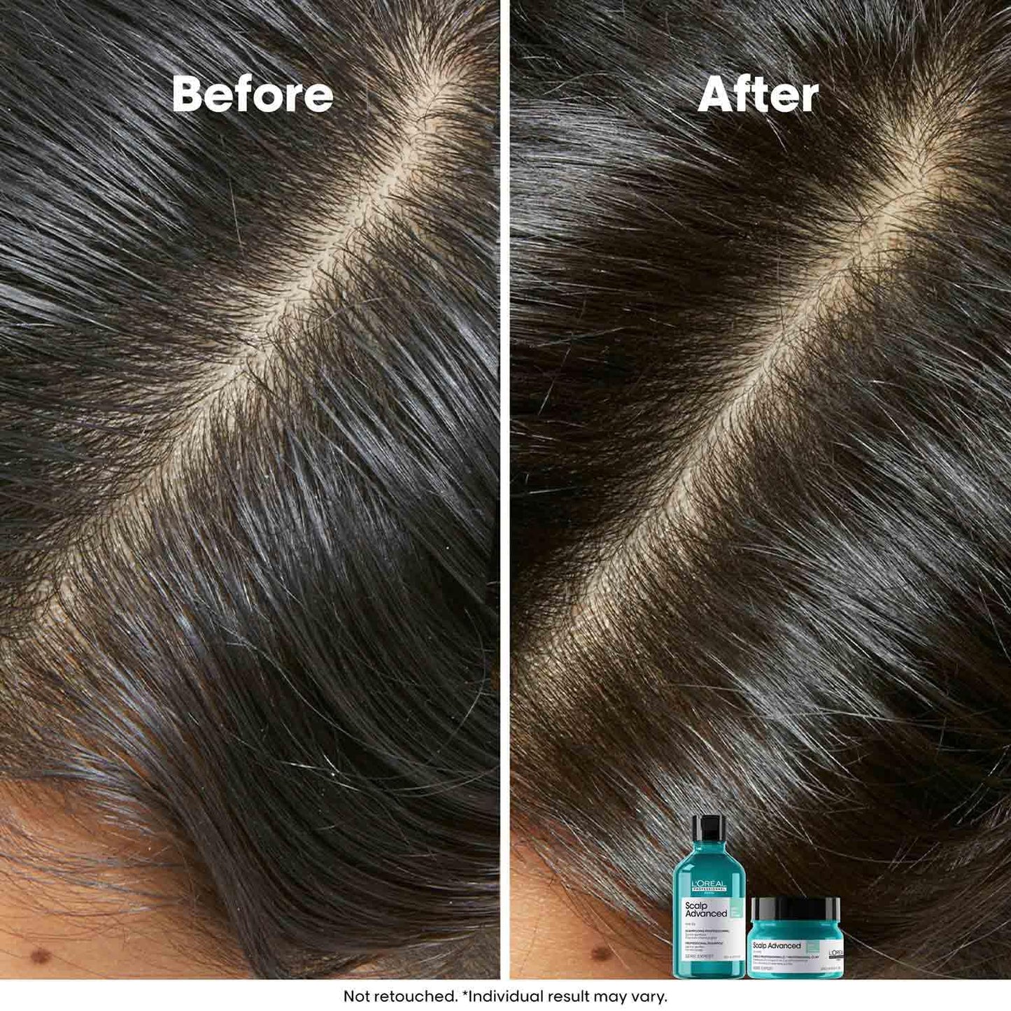 L’Oréal Professionnel Scalp Advanced Anti-Oiliness Dermo-Purifier Shampoo 300ml